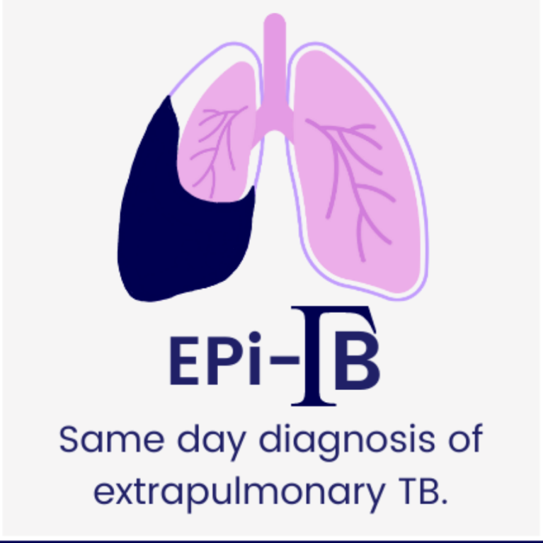 Global Health EDCTP3-funded EpiTB project logo